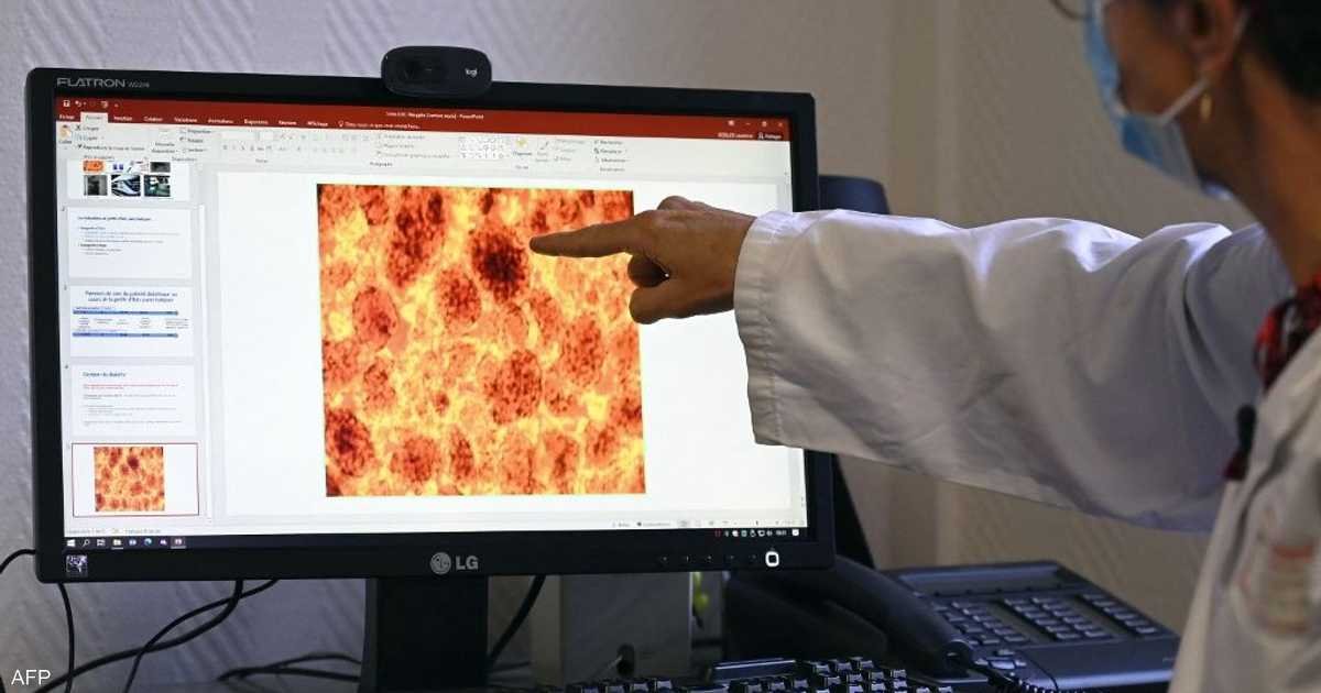 لقاح-لسرطان-البنكرياس-يظهر-نتائج-مبشرة-في-تجربة-أولية.jpg